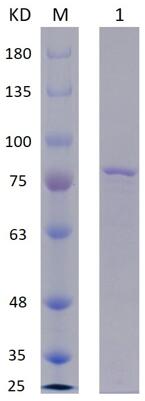 8% SDS-PAGE analysis profiles of purified PA0428-1-639 (CBB stained).